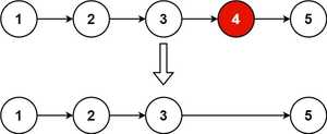 remove nth node from linked list leetcode